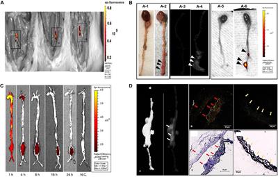 Nano-Biomaterials for the Delivery of Therapeutic and Monitoring Cues for Aortic Diseases